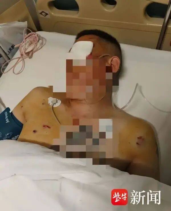 波士顿凯尔特人 vs纽约尼克斯
_男子取170万元现金银行门口遭抢波士顿凯尔特人 vs纽约尼克斯
,工作人员无动于衷