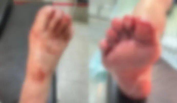 玻利维亚职业联赛_洗澡时一声巨响玻利维亚职业联赛，浙江小女孩腿上、脚上全是血！小心你家中藏的“不定时炸弹”……