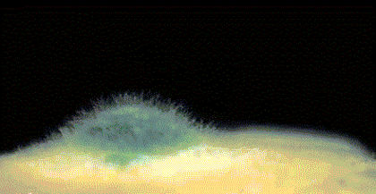 皇冠信用网代理注册_6岁女童发烧17天皇冠信用网代理注册,脑子竟被“啃”出十几个洞!“元凶”家中很常见!