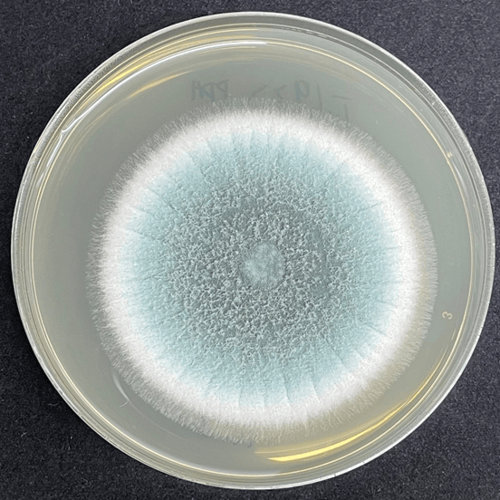 皇冠信用网代理注册_6岁女童发烧17天皇冠信用网代理注册,脑子竟被“啃”出十几个洞!“元凶”家中很常见!