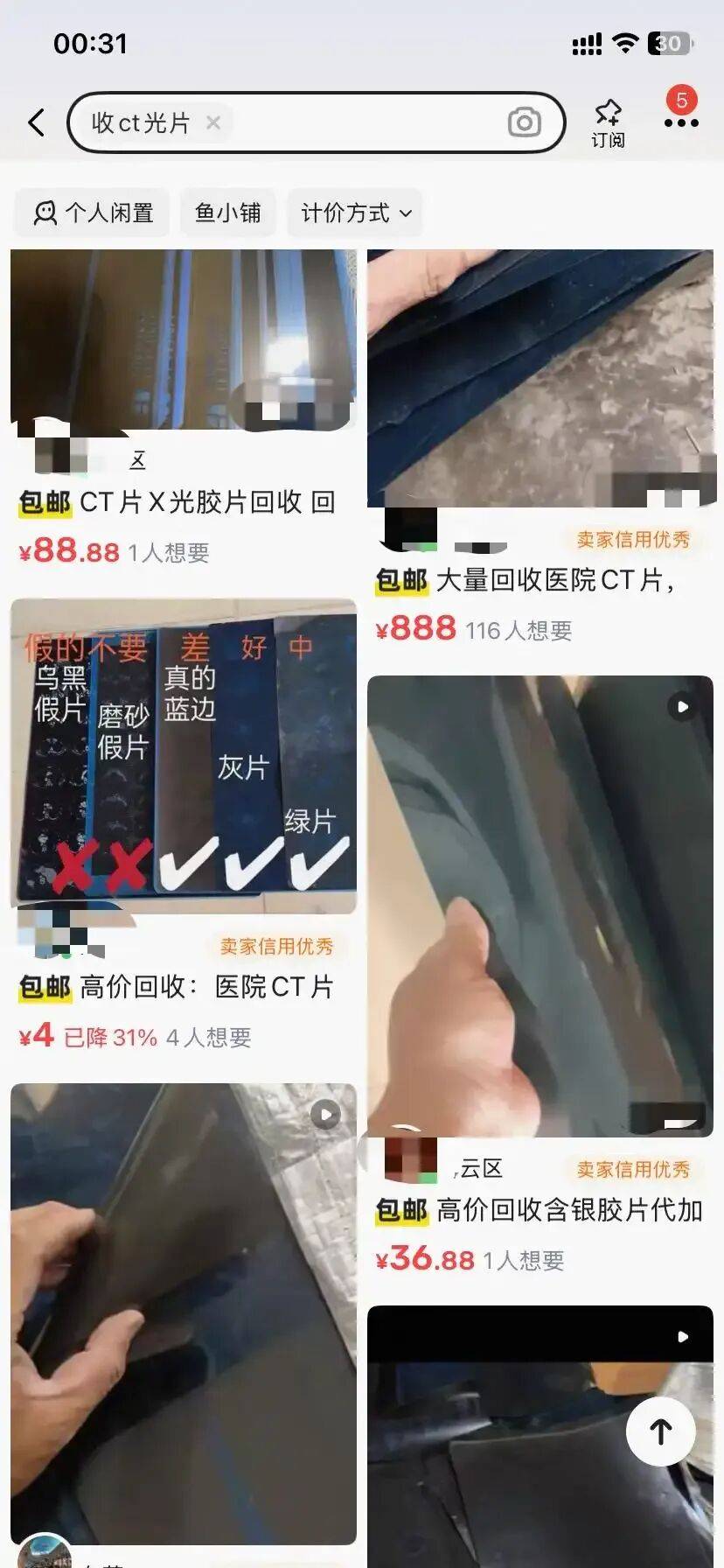 皇冠A盘_废旧医用胶片可炼银？有人称两个多月回收上万张皇冠A盘，“每张能赚1块钱”，专家：别卖