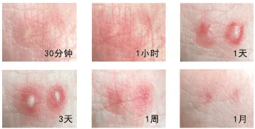 皇冠信用网如何申请_“五一假期”外出看见这种小土包皇冠信用网如何申请，千万别踩！